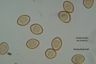 Microscopia - spore Inocybe cerrvicolor